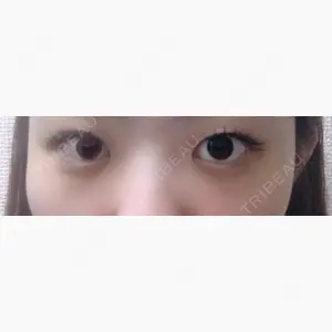 共立美容外科 柏院口コミ