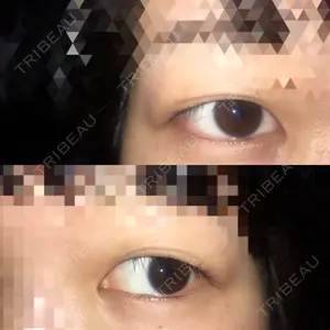 藤井美容外科口コミ