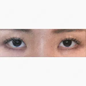 湘南美容クリニック 熊本院口コミ