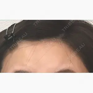 湘南美容クリニック 渋谷アネックス院口コミ