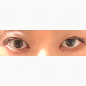 きくな湯田眼科口コミ