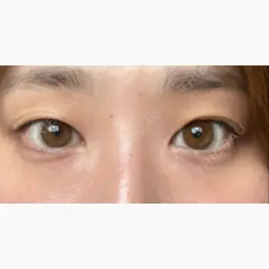 品川スキンクリニック札幌院	（品川美容外科 札幌院と統合）口コミ