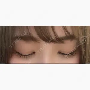 湘南美容クリニック 赤坂見附院口コミ