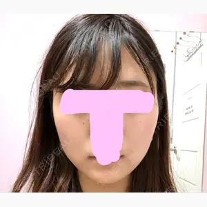 エートップ美容整形外科口コミ