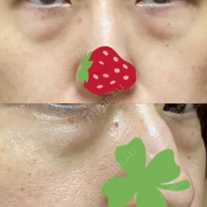 韓国ST美容整形外科口コミ