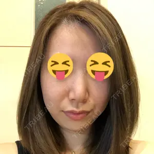 SUEクリニック銀座口コミ