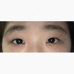 共立美容外科 柏院口コミ