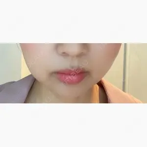 赤坂プレミアクリニック口コミ