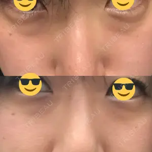 韓国ST美容整形外科口コミ