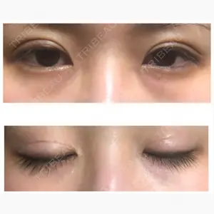 こいずみ形成クリニック名古屋口コミ