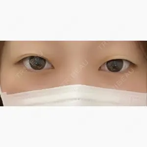 品川美容外科 大宮院口コミ