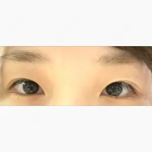 湘南美容クリニック 赤坂見附院口コミ