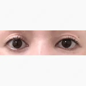 ヴェリテクリニック 大阪院口コミ