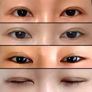 エイペックス美容外科口コミ