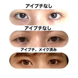 湘南美容クリニック 赤坂見附院口コミ