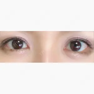 ツツイ美容外科口コミ