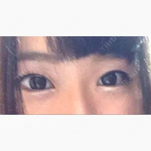 きくな湯田眼科口コミ