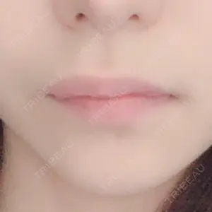 清潭女神美容外科口コミ