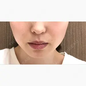 湘南美容クリニック 武蔵小杉院口コミ