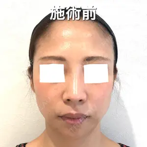 BIANCA銀座口コミ
