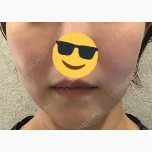 アサミ美容外科 渋谷院口コミ