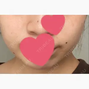 HSクリニック口コミ