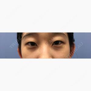 湘南美容クリニック 西葛西院口コミ