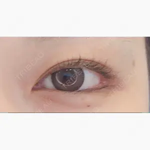 湘南美容クリニック 渋谷アネックス院口コミ