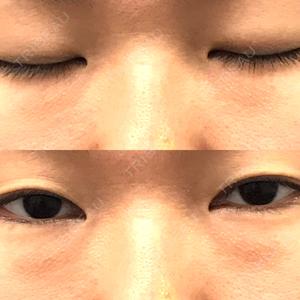 湘南美容クリニック 西葛西院口コミ