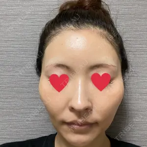 プルージュ美容クリニック 赤羽院口コミ