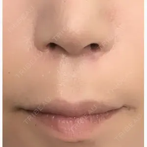 ヴェリテクリニック 大阪院口コミ