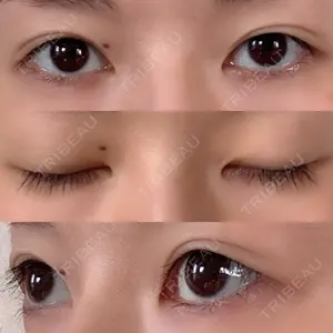 蘇春堂形成外科口コミ