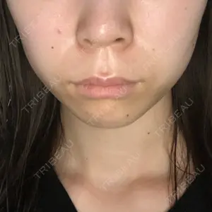 グリム整形外科口コミ