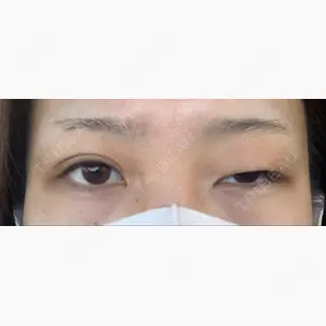 高田眼科併設眼瞼下垂治療センター口コミ