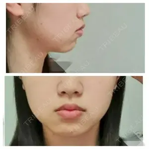 キルシェクリニック口コミ