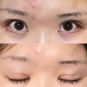 心斎橋コムロ美容外科クリニック口コミ