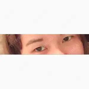 品川美容外科 大宮院口コミ