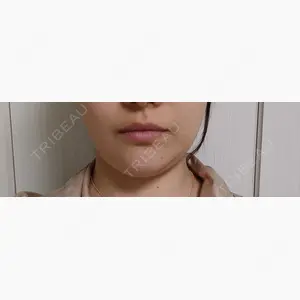 THE CLINIC（ザ・クリニック） 東京院口コミ