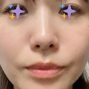 BIANCA銀座口コミ