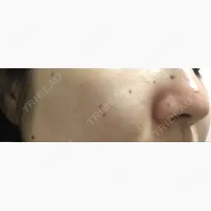 赤坂メディカルMクリニック口コミ