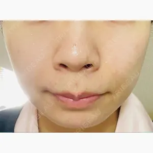 ミルディス皮フ科 北千住口コミ