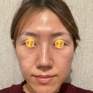 プルージュ美容クリニック 赤羽院口コミ