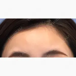 湘南美容クリニック 渋谷アネックス院口コミ