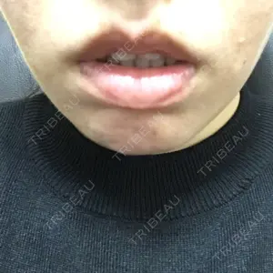 ヤマグチ堺東クリニック口コミ