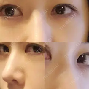 エイペックス美容外科口コミ