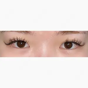 あつぎ美容クリニック口コミ