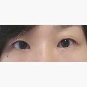 心斎橋コムロ美容外科クリニック口コミ