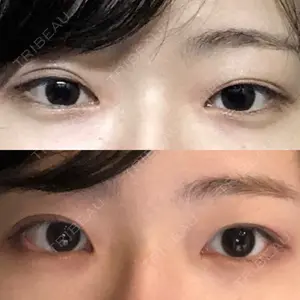 品川美容外科 新宿院（※品川スキンクリニック提携）口コミ