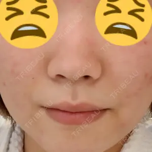 エイペックス美容外科口コミ