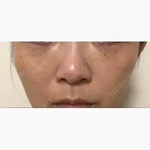 ベル美容外科クリニック口コミ